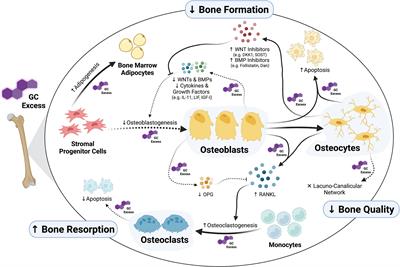 Bad to the Bone: The Effects of Therapeutic Glucocorticoids on Osteoblasts and Osteocytes